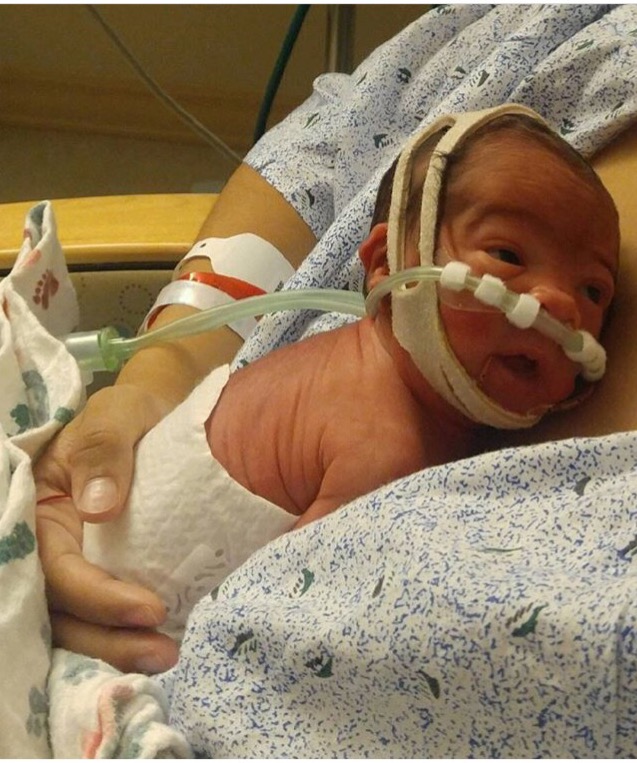 Baby Born In Amniotic Sac On Way To Hospital